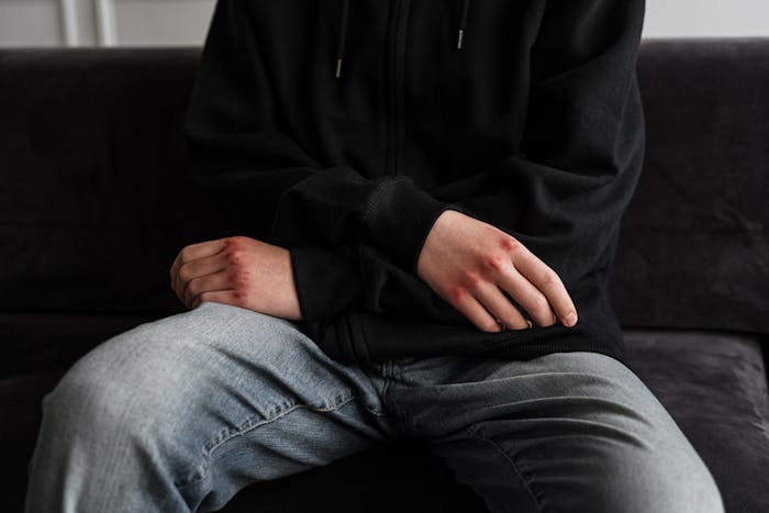 Dangers and Risks of Self-Harm
