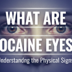 What are Cocaine Eyes