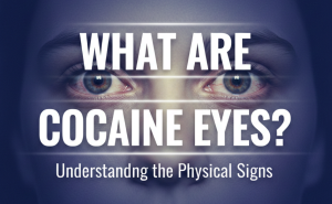 What are Cocaine Eyes